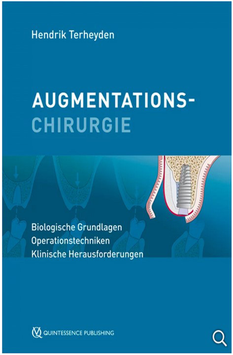 DAS LEHRBUCH VOM EXPERTEN DER AUGMENTATION - Prof. Dr. Dr. Terheyden